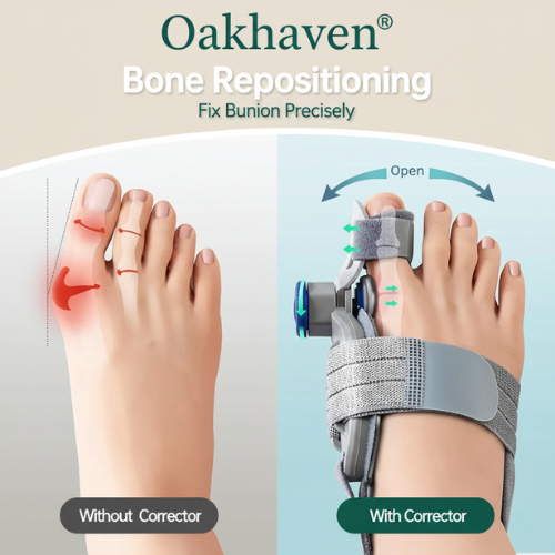 Oakhaven® | Orthopedic Toe Straightener